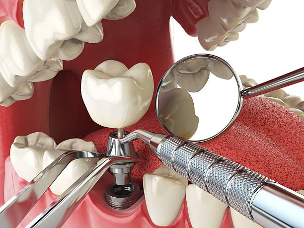 Best Emergency Dental Extractions in Carroll Valley, PA